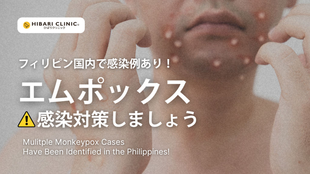 PH monkeypox blog thumbnail
